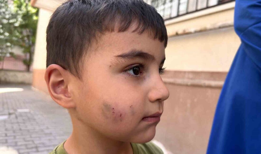 Ankara’nın Sincan ilçesinde evde uyurken lağım faresi tarafından ısırılarak yaralanan