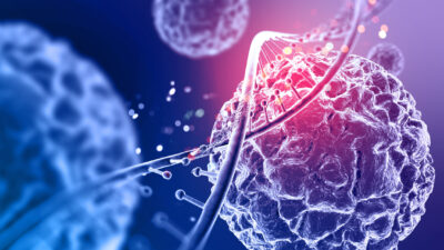 Kadınlarda en sık görülen kanser türünün meme kanseri olduğuna dikkat