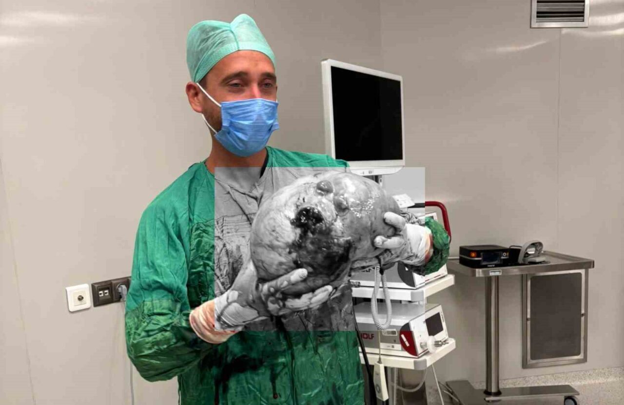 Yozgat Şehir Hastanesi’ne karın ağrısı şikayetiyle başvuran 70 yaşındaki kadın