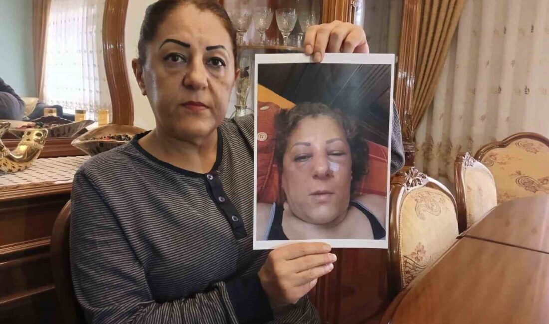 Ankara Yenimahalle'de ikamet ettiği apartmanın bahçesinde beslediği kediler nedeniyle husumetli