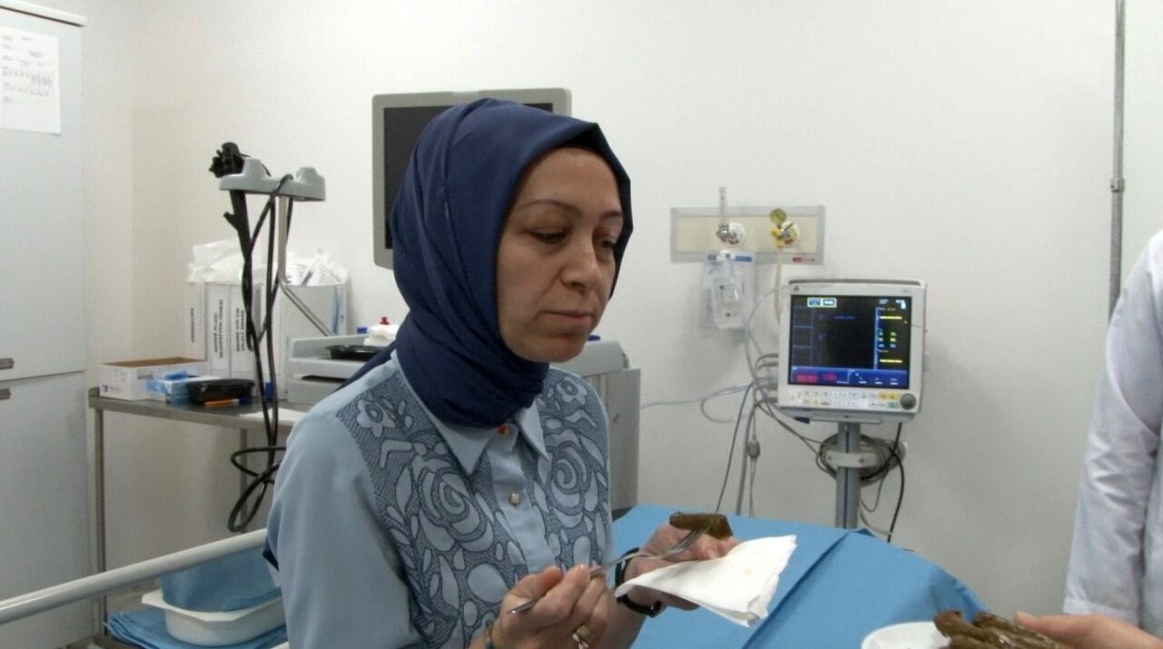 Yutma güçlüğü, katı gıda yemekte zorlanma ve şiddetli göğüs ağrıları